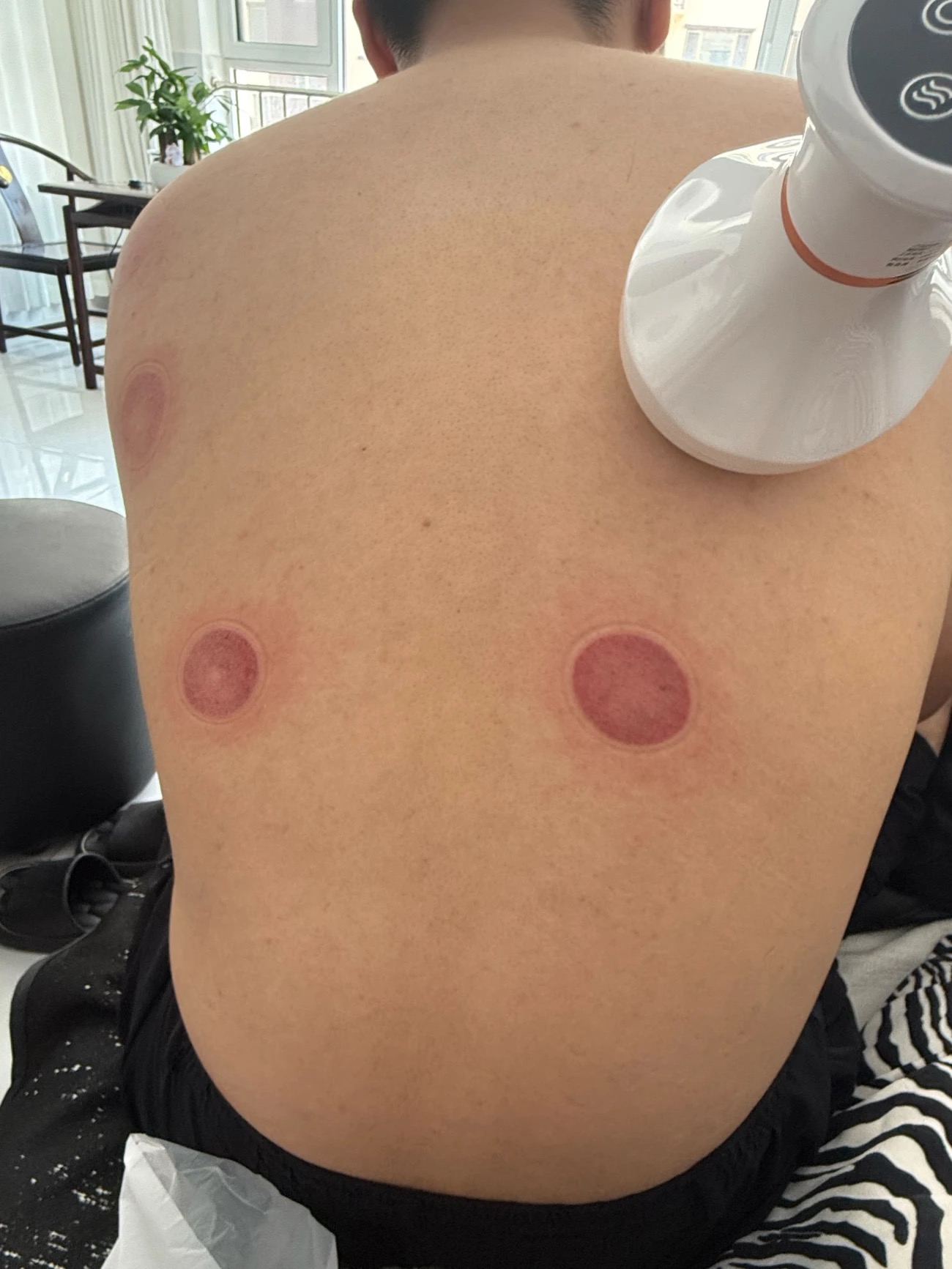 가정용 웰니스를 위한 전동 괄사 기기: 온열 요법, 흡입, 경락 소통, 부항 기능을 갖춘 스마트 마사지기 photo review