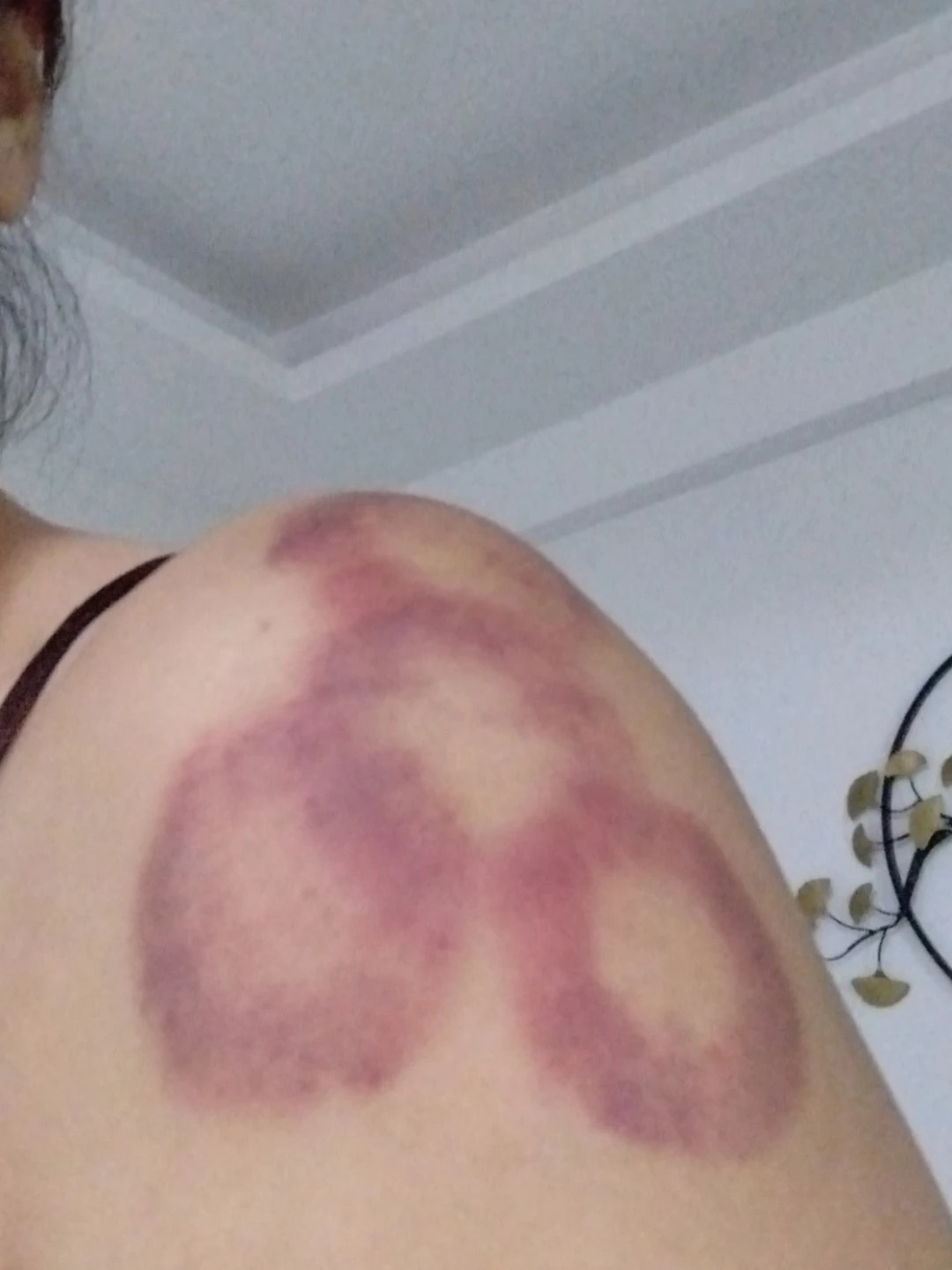 가정용 웰니스를 위한 전동 괄사 기기: 온열 요법, 흡입, 경락 소통, 부항 기능을 갖춘 스마트 마사지기 photo review