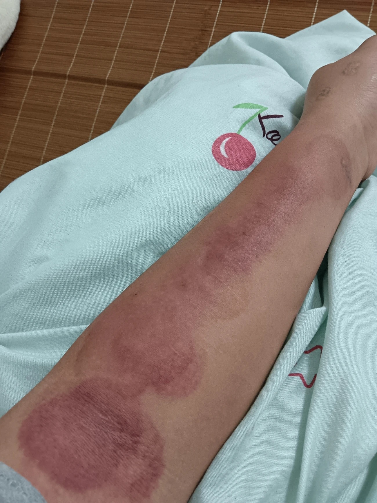 가정용 웰니스를 위한 전동 괄사 기기: 온열 요법, 흡입, 경락 소통, 부항 기능을 갖춘 스마트 마사지기 photo review